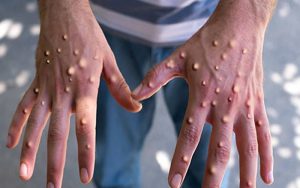 news-1775810202-7229