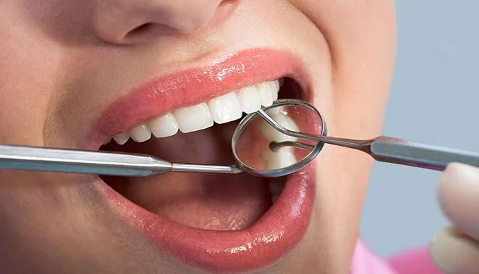 مسوڑھوں سے خون آنا گردوں کی بیماری کی ابتدائی علامت ہو سکتا ہے، نئی تحقیق